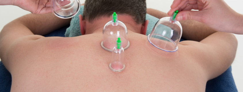 how cupping can help your performance