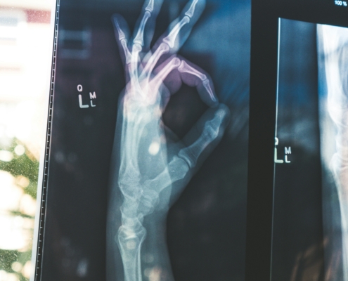 Strong bones, peak performance. Regular structural check-ins and proper nutrition ensure your skeletal system can handle the high-impact demands of training.