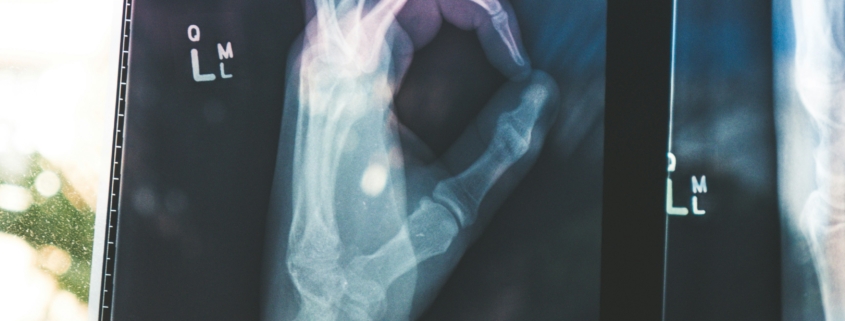Strong bones, peak performance. Regular structural check-ins and proper nutrition ensure your skeletal system can handle the high-impact demands of training.